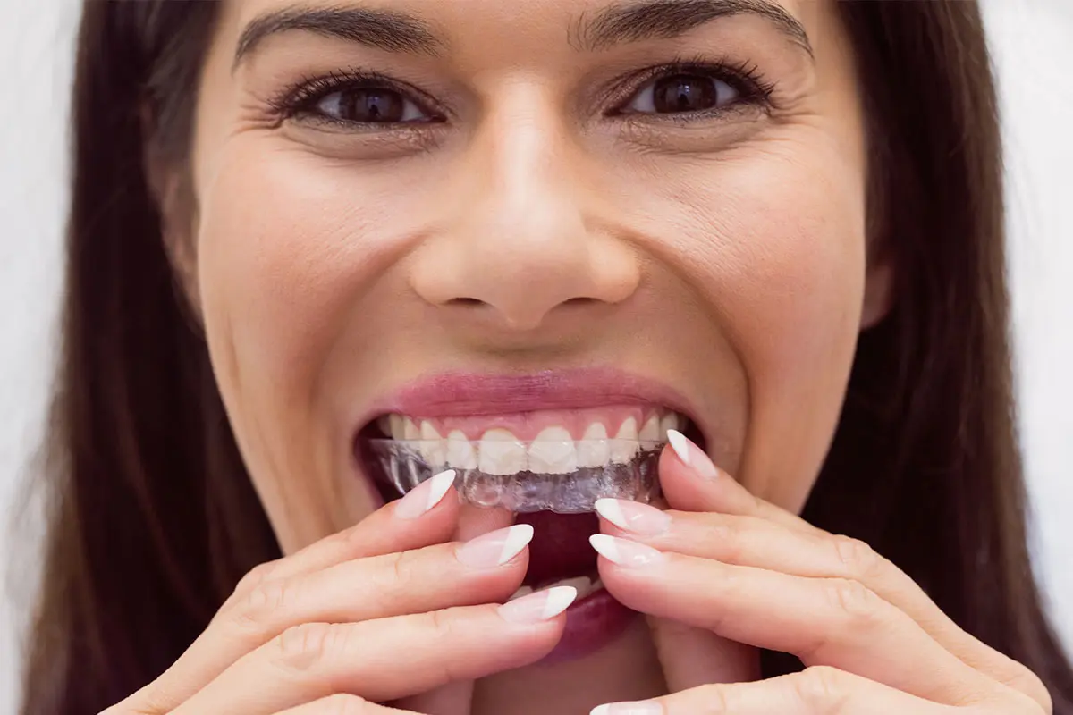 Aligner Tedavisi Fiyatları