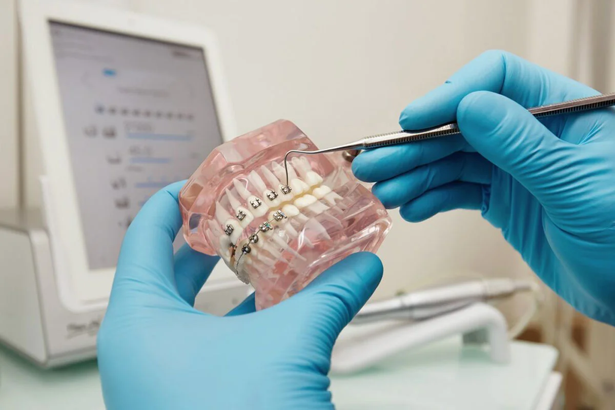 Ortodonti Tedavisi Fiyat