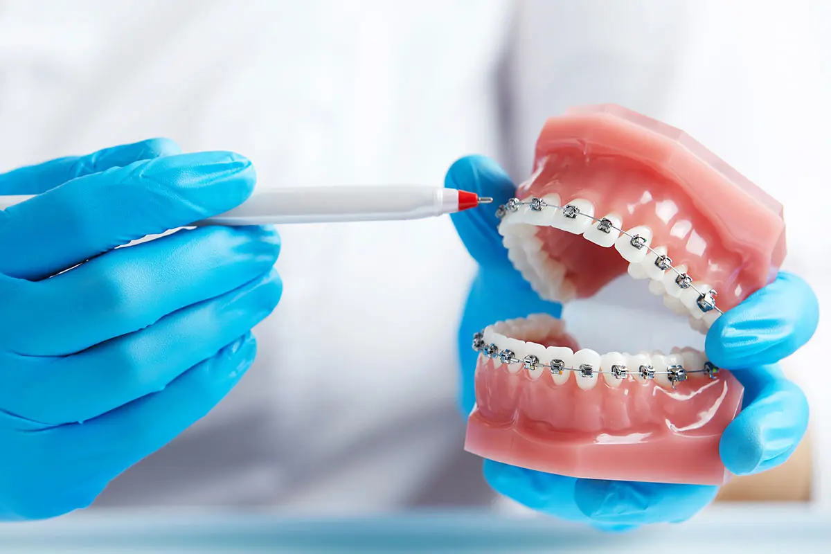 All on Six İmplant Nedir