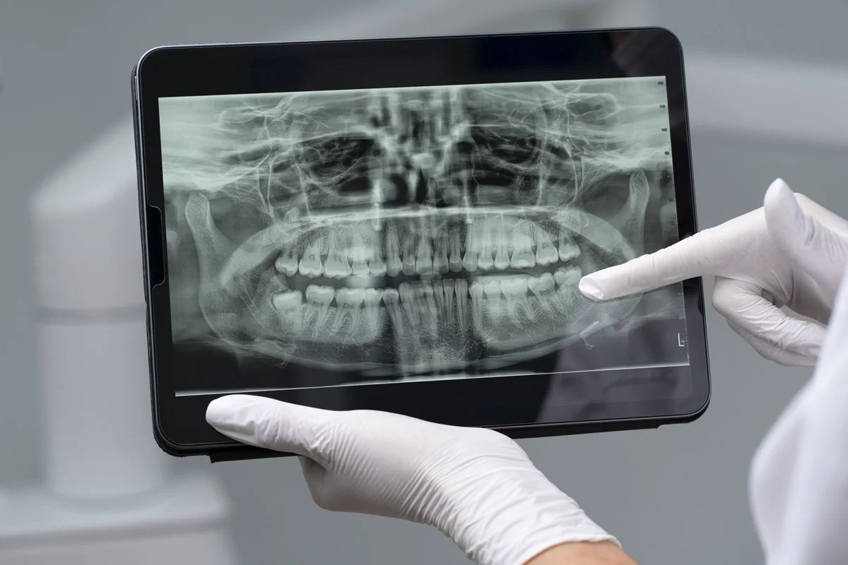 Dijital Diş Hekimliği Nedir