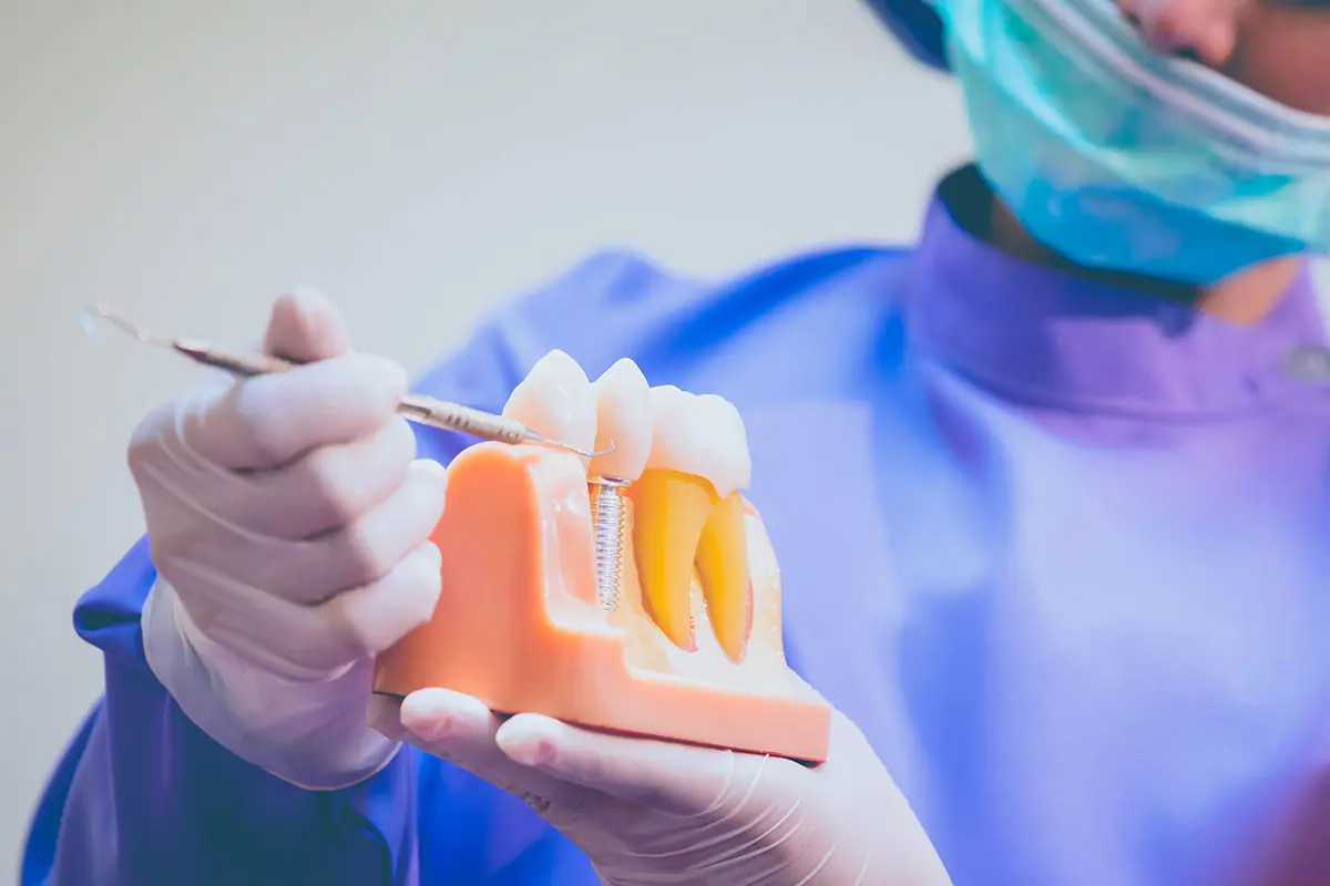 Kök Kanal Tedavisi Nedir