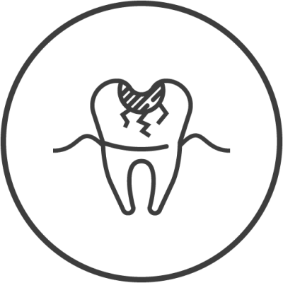 العلاج التحفظي للأسنان (تطبيقات الحشو)