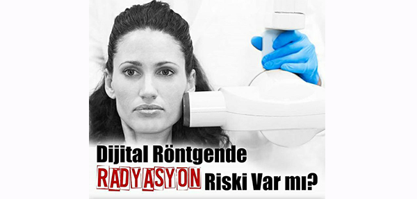 IS THERE A RADIATION RISK IN DIGITAL X-RAY?