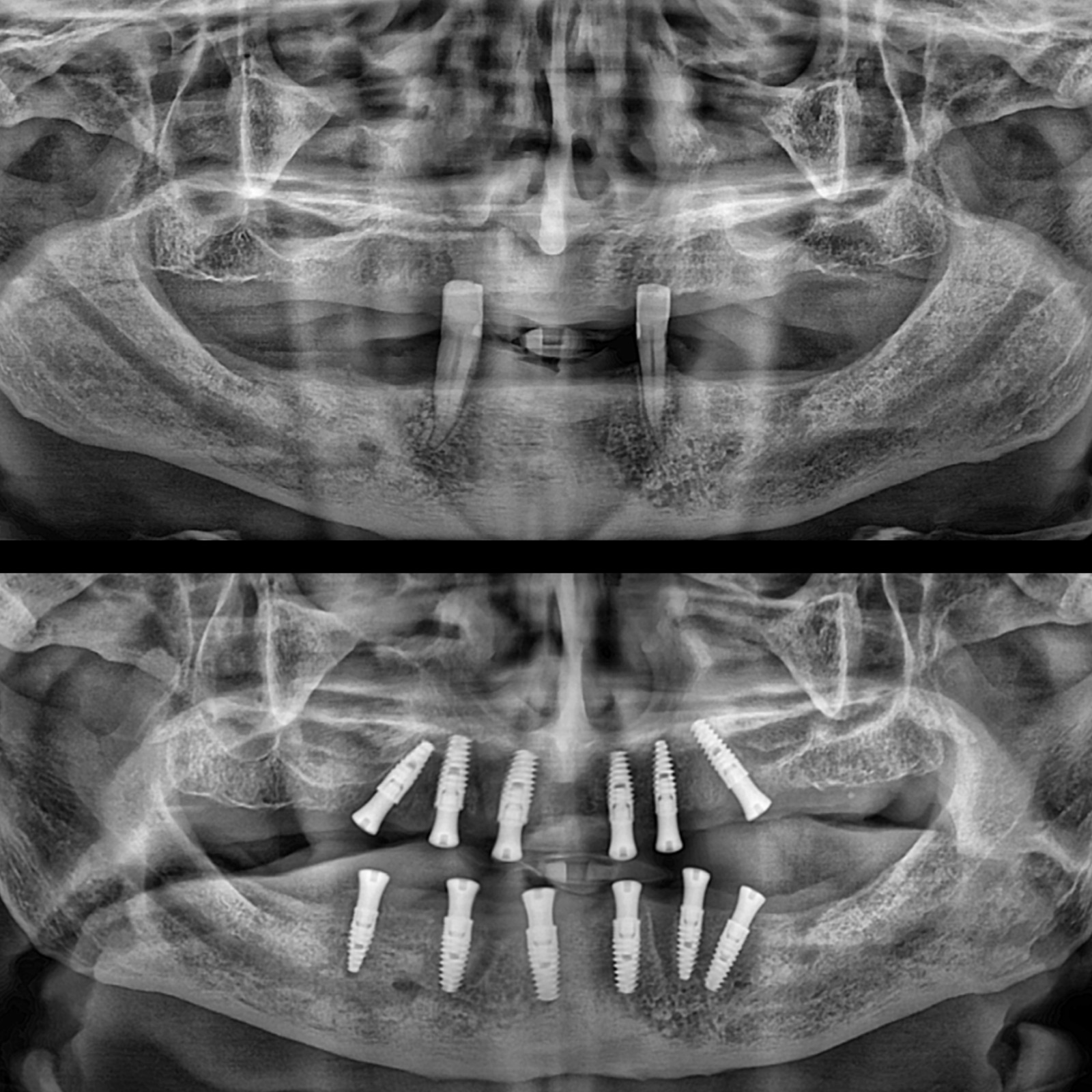 Ağız Diş ve Çene Cerrahisi (Çekimler , İmplant Uygulamarı)