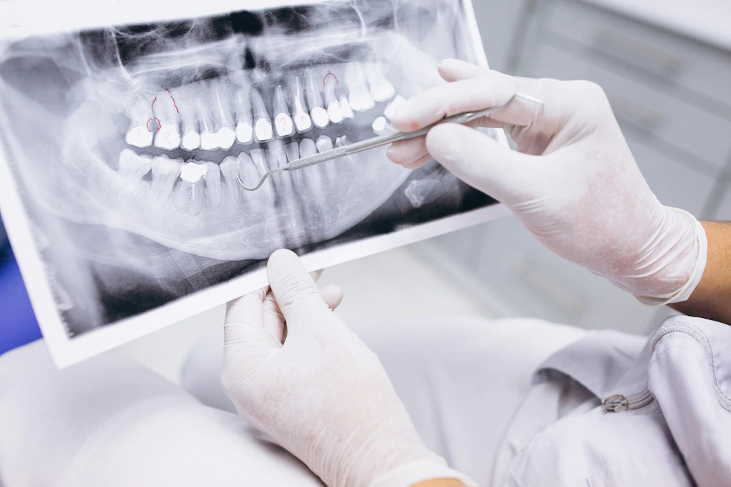 Oral Diagnoz ve Radyolojı(Teşhis ve Planlama)