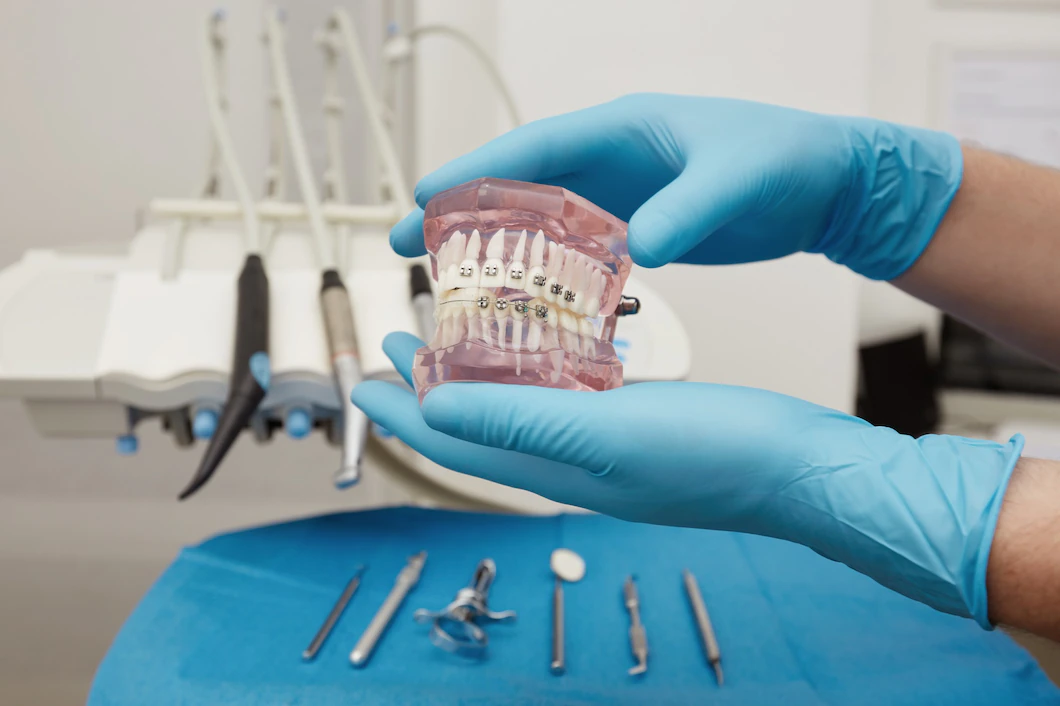 Ortodonti (Diş Teli Uygulamaları)