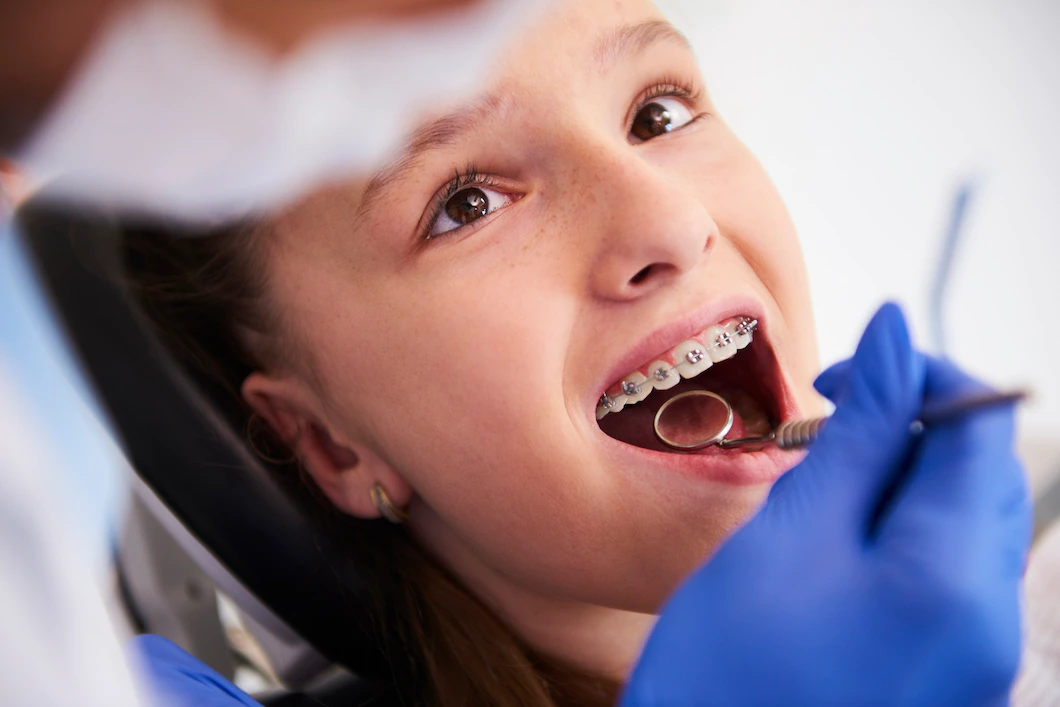 Ortodonti (Diş Teli Uygulamaları)